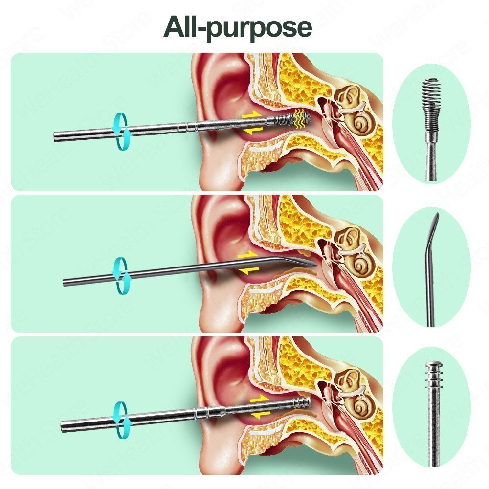 KIT EAR CLEANER